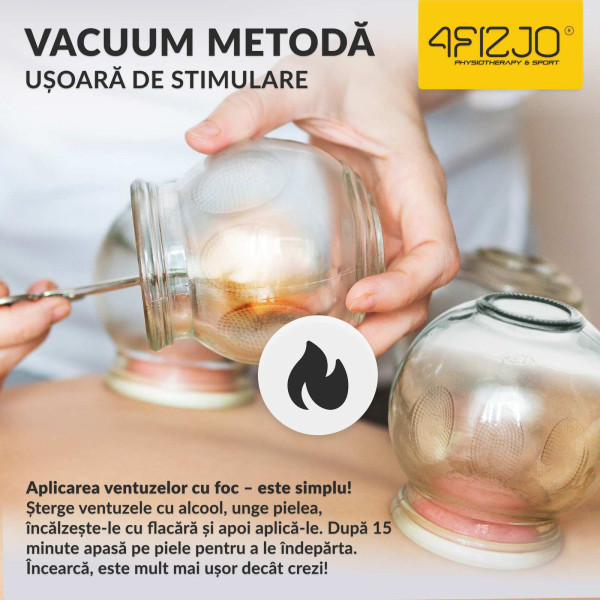 SET VENTUZE STICLA X 20 BUC 30 MM